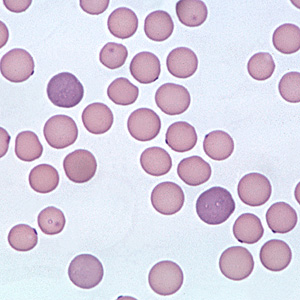 Kedilerde Haemobartonellosis